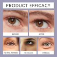 thumbnail image 4 of Bee Venom Wrinkle-Reducing And Firming Eye Cream Reduces Dark Circles And Eye Bags, Anti-wrinkle And Firming, Improves Fine Lines, 4 of 5
