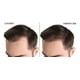 thumbnail image 5 of Loción Noxidil-h2. The Shaving Co. Sistema Regenerador amarillo 1, 5 of 7