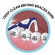 thumbnail image 5 of OrVance Braces Flosser - Diseñado para aparatos ortopédicos para una limpieza fácil y efectiva, hilo dental ultra fuerte - 40 unidades (paquete de 1), 5 of 8