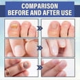 thumbnail image 2 of Nail Repair Light Therapy Led Lamp Hand Foot Nails Yellow Soft Nail, 2 of 5