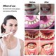 thumbnail image 5 of Removedor de cálculo Dental ultrasónico, escalador de placa Dental, eliminador de sarro, limpiador de manchas, eliminador de piedra Dental eléctrico, 5 of 5