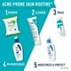 thumbnail image 4 of Sérum CeraVe Retinol para marcas posteriores al acné y textura de la piel, 30 ml CeraVe  NA, 4 of 7