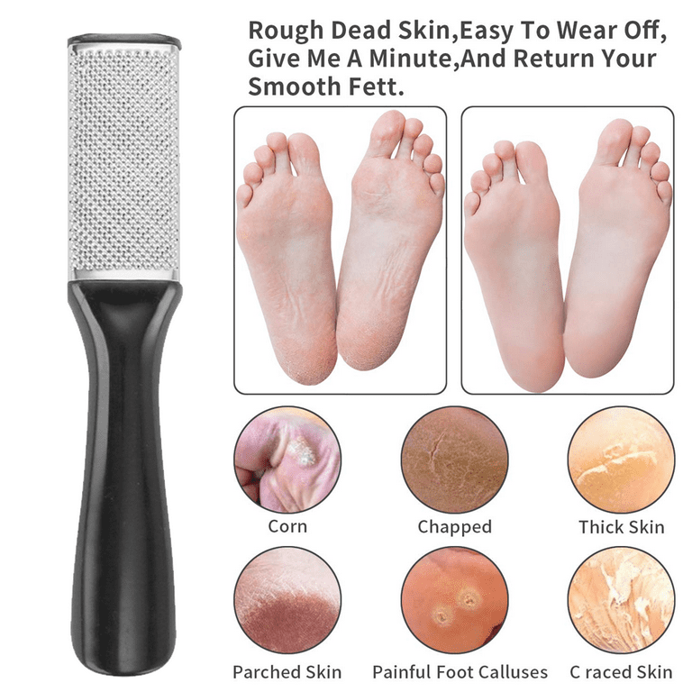 Foot Callus Remover for Feet - Professional Foot Scrubber Dead Skin Remover  with Medical Grade Steel - Ergonomic and Easy to Use Foot File Callus  Remover for Feet - Quality Pedicure Grater