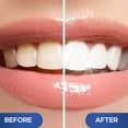 thumbnail image 3 of Bolígrafo blanqueador dental VENUS VISAGE, 4 unidades, menta, más de 20 usos, 3 of 6