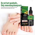 thumbnail image 4 of Suero reparador de uñas Zulema 50ml, 4 of 8