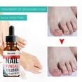thumbnail image 3 of Nail Fungal Treatment and Repair Solution for Fingernails and Toenails, 1-3 Pieces, 3 of 5