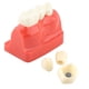 thumbnail image 3 of 1 modelo dental de demostración dental de resina, modelo de kit dental de tres coronas, análisis de implantes desmontable puente de corona dental, para programas de enseñanza dental brillar Electrónica, 3 of 5
