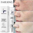 thumbnail image 3 of Effective Whitening Freckles Cream Remove Dark Spots Fade Melanin Anti-Pigmentation Improve Dullness Fast Brighten Skin Care New, 3 of 5