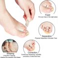 thumbnail image 5 of 4 Pieces Hammer Toe Hammer Toe Support Toe Splint For Toes, Hammer Toes, Claw Toes (one Toe) Banmo, 5 of 5