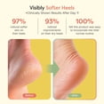thumbnail image 4 of Calcetines hidratantes para dormir ZenToes con vitamina E y aceite de oliva, 4 of 8