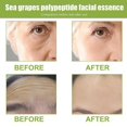 thumbnail image 4 of Sérum Facial au Raisin de Mer, Sérum Hydratant pour le Visage au Raisin de Mer, Rétrécit les Pores Hydrate et Hydrate la Peau, pour Tous Types de Peau, 4 of 5