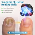 thumbnail image 3 of Zvous Nail Fungus Treatment Device, Toenail Fungus Laser with 940nm Infrared & 500nm Blue Light, Home Antifungal Light Therapy, Easy to Use (BLACK), 3 of 6