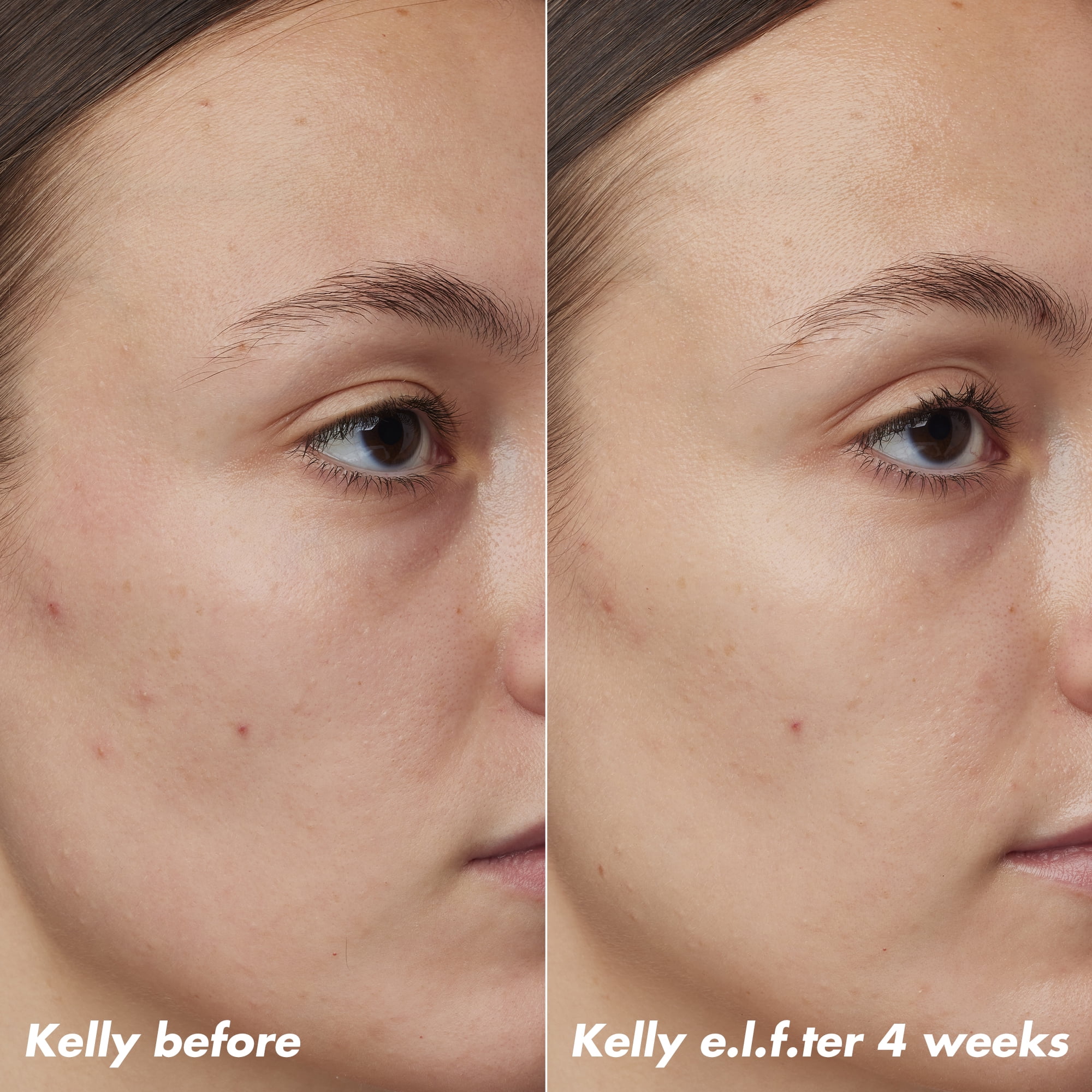 e.l.f. SKIN PLZ Clarify Facial Oil, 2% Salicylic Acid Acne Treatment + Aloe Extract, 1 fl oz
