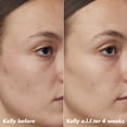 thumbnail image 6 of e.l.f. SKIN PLZ Clarify Facial Oil, 2% Salicylic Acid Acne Treatment + Aloe Extract, 1 fl oz, 6 of 16