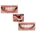 thumbnail image 2 of Dientes falsos, dentadura postiza, carillas temporales a presión, cubren los dientes imperfectos, arreglan una sonrisa segura, dientes falsos temporales, 2 of 5