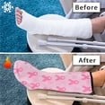 thumbnail image 7 of Jiueut Breast Cancer Leg Cast Cover Pink Ribbon Stretch Fabric Leg Cast Protector Size L Decorative Leg Plaster Cover Leg Plaster Sleeve Easy to Put on Leg Cast Cover for Showering, 7 of 7