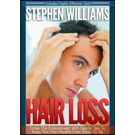 Hair Loss: Erase The Embrassment With Helpful Tips To Keep Your Hair Healthy From Scalp To Tip -