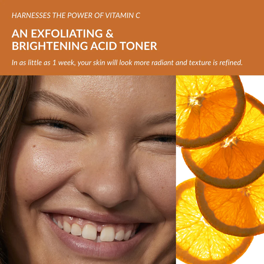 Avon Anew Radiance Maximising Vitamin C Tonic – Brightening & Exfoliating Facial Toner, 6.76 fl oz / 200 ml