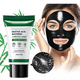 thumbnail image 2 of Trio Serum Crema Y Mascarilla Acido Salicilico Anti Acne, 2 of 7