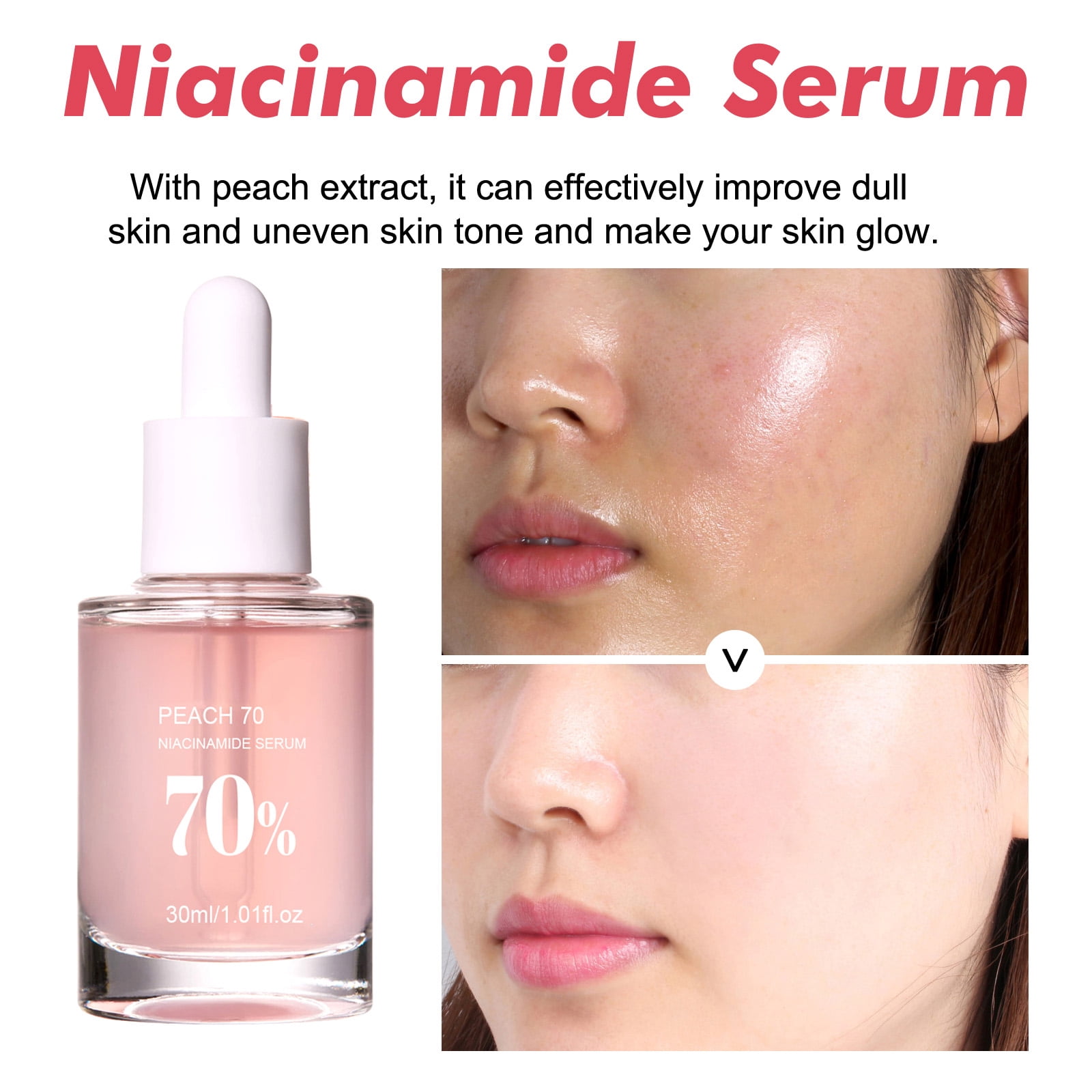 Alvantor Peach 70 Niacinamide Face Serum, Pore Minimizer Dark Spot Corrector Brightening Hydrating Treatment, 1.01fl.oz