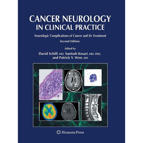 Cancer Neurology in Clinical Practice: Neurologic Complications of Cancer and Its Treatment, (Paperback)
