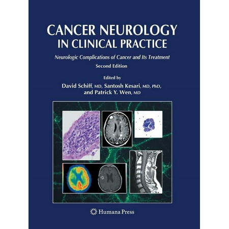 UPC: 9781627039543 | Cancer Neurology in Clinical Practice: Neurologic Complications of Cancer and Its Treatment (Paperback)