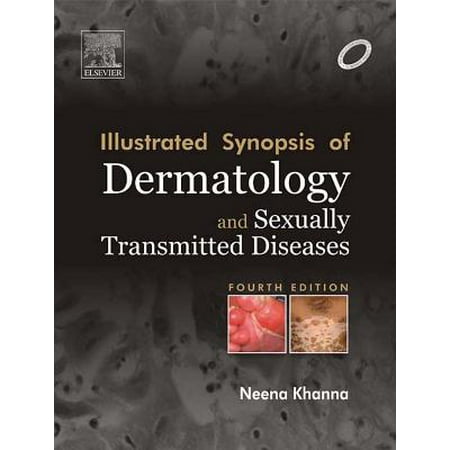 Illustrated Synopsis of Dermatology & Sexually Transmitted Diseases - E-book -