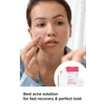 thumbnail image 3 of Parches para el cuidado del acné DERMALOGY de NEOGENLAB A-CLEAR SOOTHING, 3 of 8