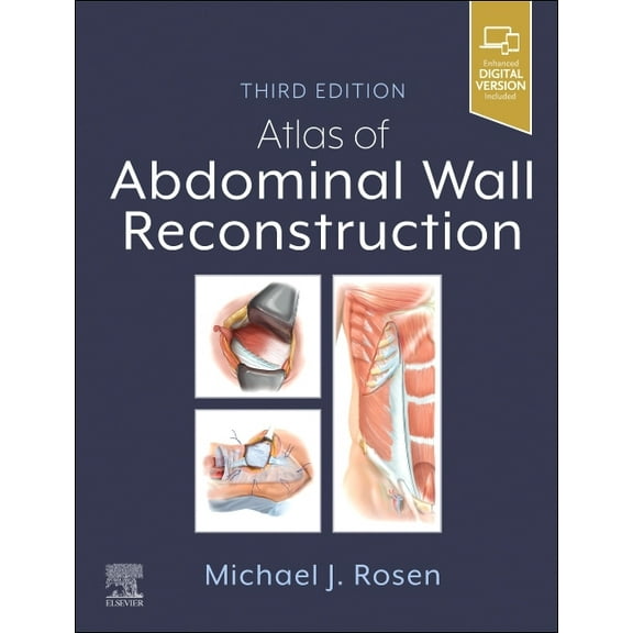 Atlas of Abdominal Wall Reconstruction, (Hardcover)