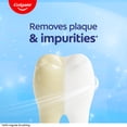 thumbnail image 5 of Colgate Baking Soda and Peroxide Whitening Toothpaste, Brisk Mint, 3 Pack, 6 oz, 5 of 17