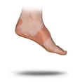 thumbnail image 3 of FasciaDerm System for Plantar Fasciitis, 3 of 4
