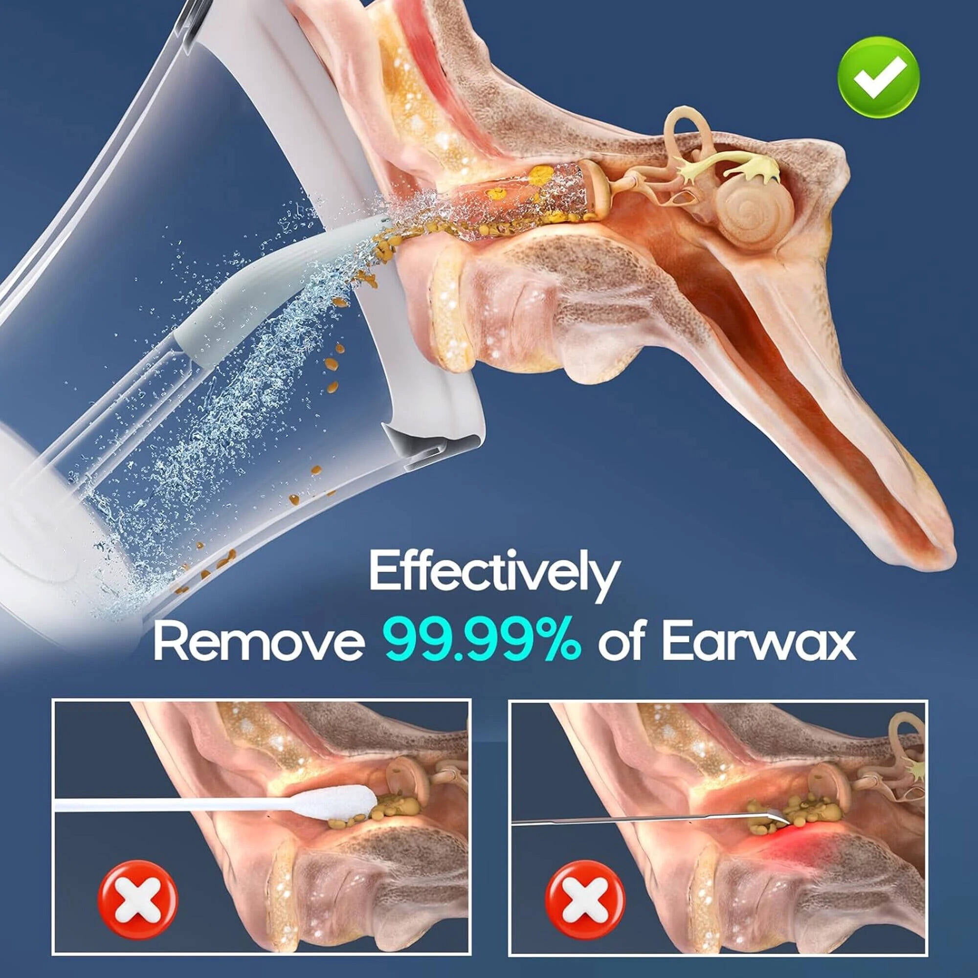 Morfone Ear Wax Removal with One-Piece Waste Tank, Ear Cleaner with Water Temperature Sensor, 4 Pressure Settings, Ear Cleaning Kit for Ear Wax Buildup & USB-C Cable, IPX6, White