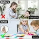 thumbnail image 4 of Tricotilomanía Fidget Toys Skin Picking Anti Stress Squeeze Toy, 4 of 9