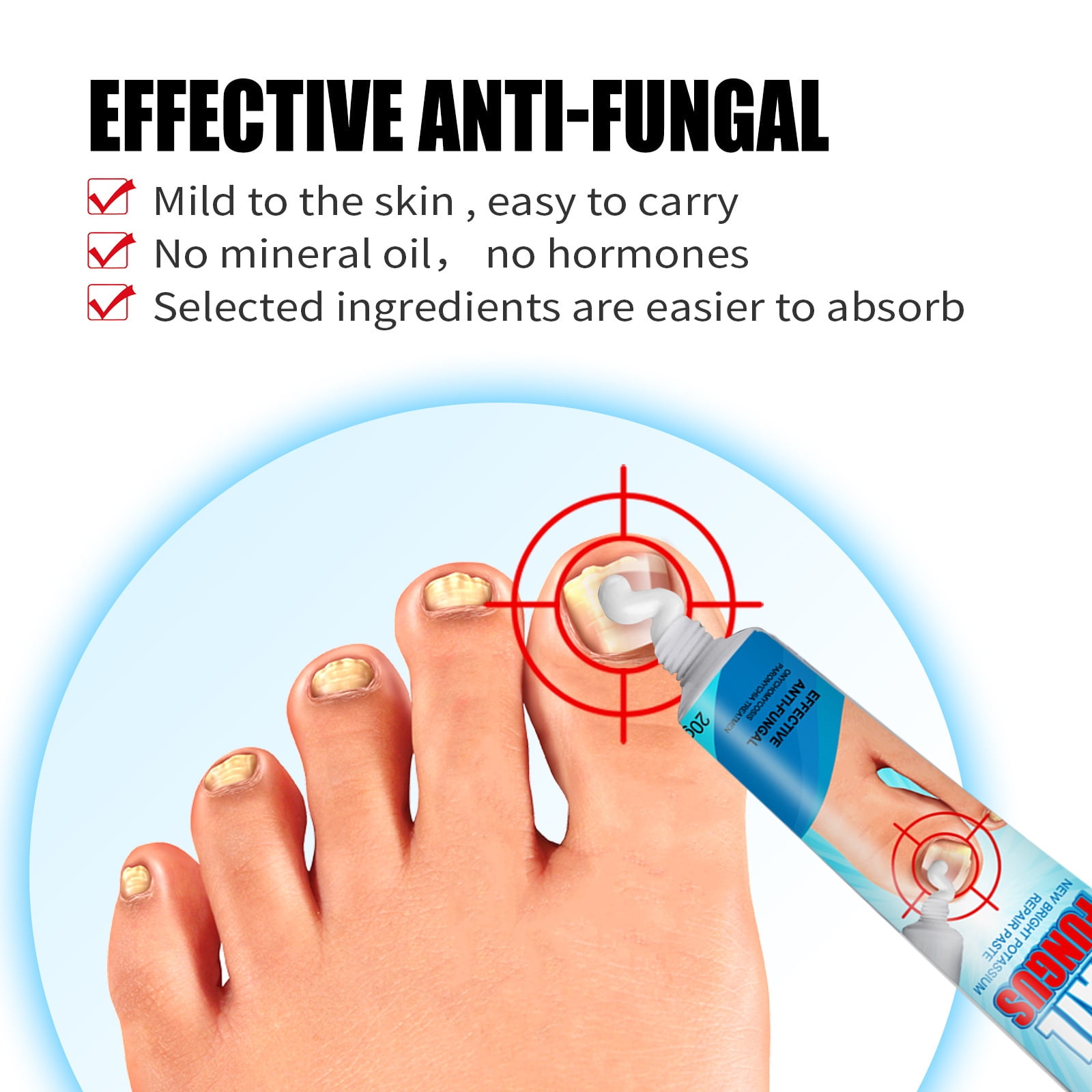 Fungal Nail Infection - Waverley Foot Clinic