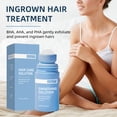 thumbnail image 4 of Ingrown Hair Treatment Serum – Smoothing Solution for Razor Bumps & Hair Removal Aftercare | Hydrating Care for Underarms, Legs, Bikini Line & Arms(2PCS), 4 of 8