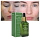 thumbnail image 4 of Cuidado eficaz de la piel facial Manchas de acné Eliminación de cicatrices Marcas 17 ml, 4 of 4