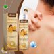 thumbnail image 5 of Ganfancp Bee Hair Keratosis Spray Nutre Los Desobstruye Los Folículos Capilares y Exfolia Al Tiempo Que Aporta Beneficios Hidratantes 20Ml Ofertas Del Día Liquidación Una Botella de Spray., 5 of 7