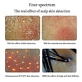 thumbnail image 5 of MEIBOYI 11 Inch LCD Skin Hair Scalp Analyzer Detector Digital Microscope Magnifier Skin Hair Blackhe, 5 of 5