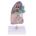 thumbnail image 2 of 2: 3 Modelo Reproducción de Patología de Estructura Pulmonar Exhibición para Enseñanza Médica Escolar Baoblaze Estatua humana del pulmón, 2 of 8