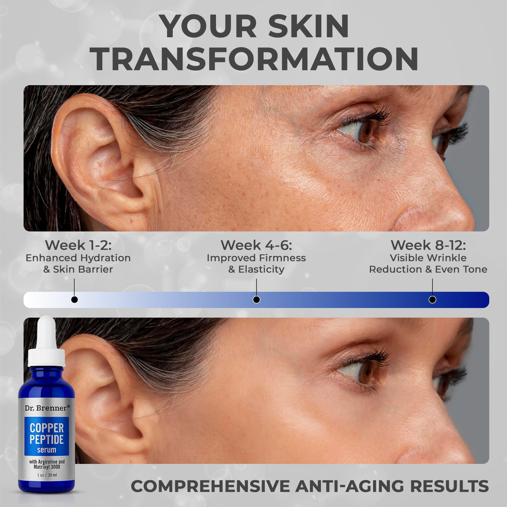 does ghk cu increase bone mass Dr. Brenner Copper Peptide Serum with GHK-Cu Barbados