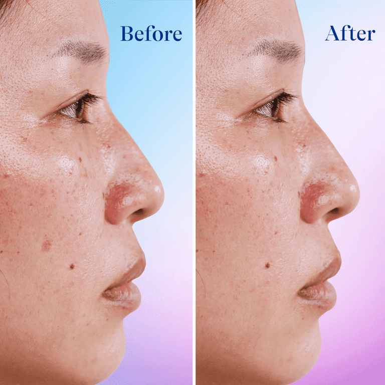 Differin Dark Spot Correcting Serum with 4 Niacinamide for Dark