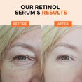thumbnail image 4 of Sérum +1 HEROLABS Retinol al 2,5% con vitamina B5, vitamina C, E y ácido hialurónico, 4 of 6