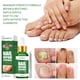 thumbnail image 5 of Esencia de reparación de uñas 30ml Aceite de nutrición para uñas Tratamiento de uñas Aceite de esencia Tratamiento de uñas natural para uñas y Colco Aceite de esencia de uñas, 5 of 8