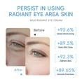 thumbnail image 4 of Intensed Eye Repair And Firming Cream Eliminates Eye Bags Fine Lines And Wrinkles For Brighter More Eyes 15g, 4 of 8