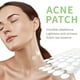 thumbnail image 5 of Essential oils Essential Oil Acne Patch Transparent Microneedle Pimple Patches 2 Size For Unseeable Makeup Waterproof Moisturizing Acne Patch To Close Acne And Fade Acne MarksMar(buy 2 get 10% off), 5 of 5