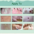 thumbnail image 4 of 12 uds. Parches para callos y verrugas plantares, herramienta para espinas, adhesivos para dedos de los pies, 4 of 7