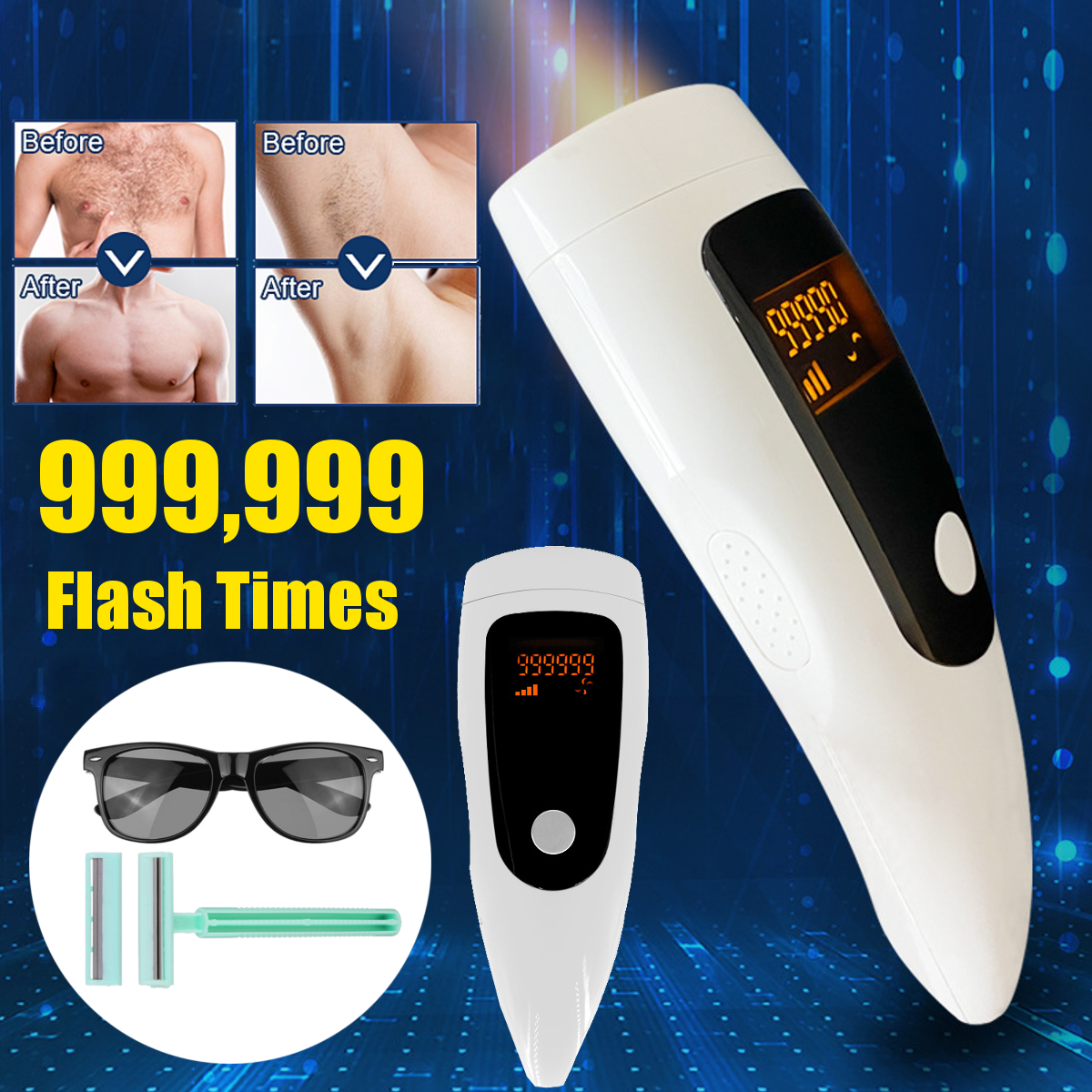 Electric Hair removal IPL Laser Hair Remover 990,000 Flashes LCD