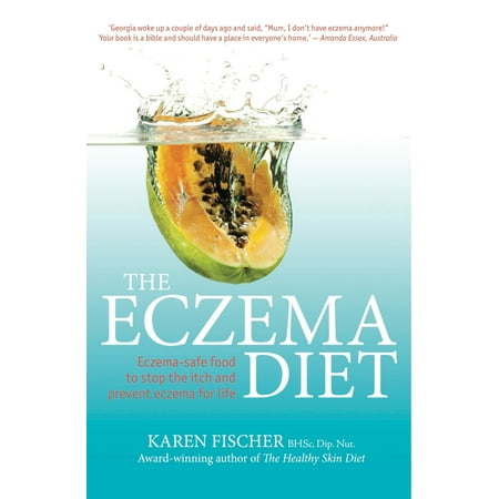 The Eczema Diet: Eczema-safe food to stop the itch and prevent eczema for life - (Best Way To Stop Itchy Eyes)