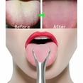 thumbnail image 2 of RAGUPEL Stainless-Steel Tongue Scraper Metal Tongue Cleaner Dental Care, 2 of 4