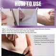 thumbnail image 4 of EELHOE 40*150mm x 4Pcs Adhesive Silicone Scar Sheets Safety Mild Fade Scar Scar Reduction Therapy, 4 of 5